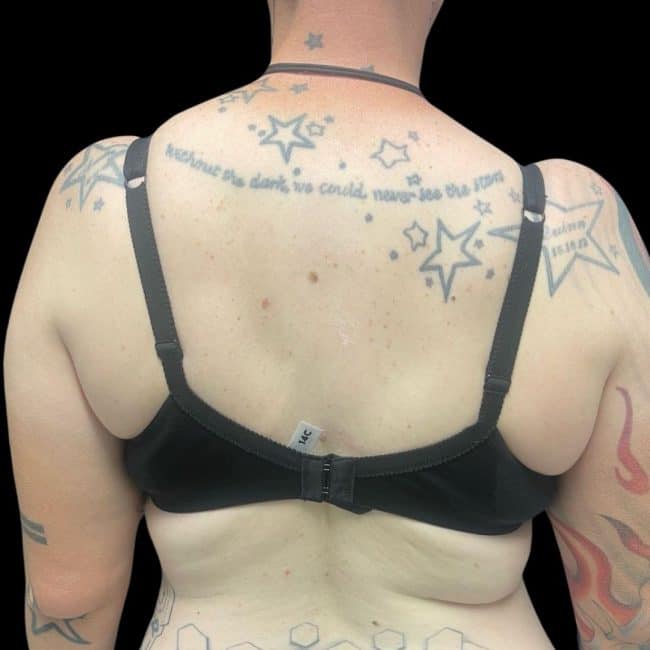 Before Back Tattoo Cover-Up 1