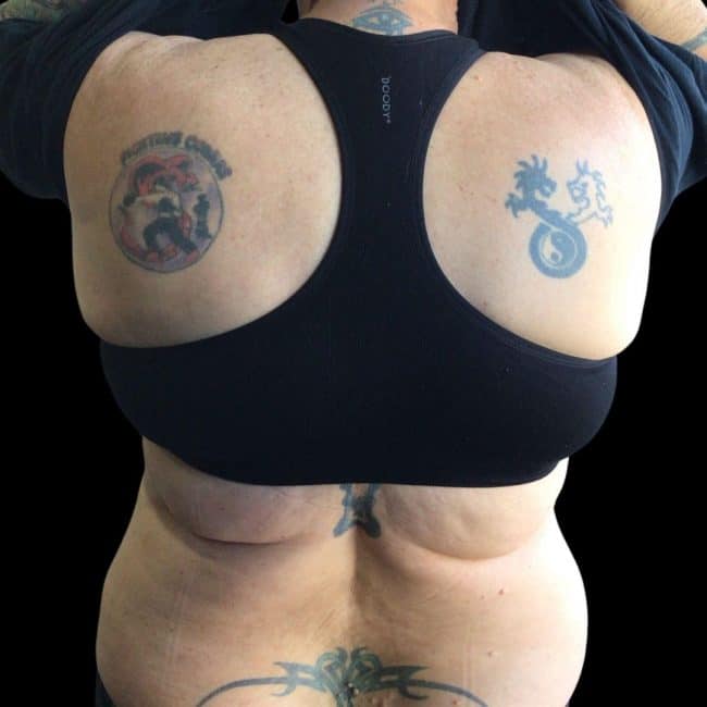 Before Back Tattoo Cover-Up 2