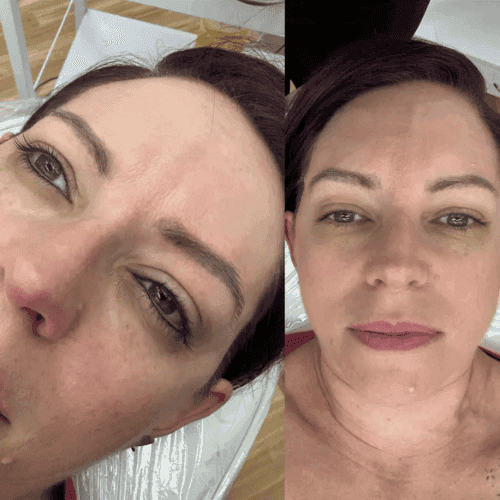 Eyeliner Tattoos Brisbane