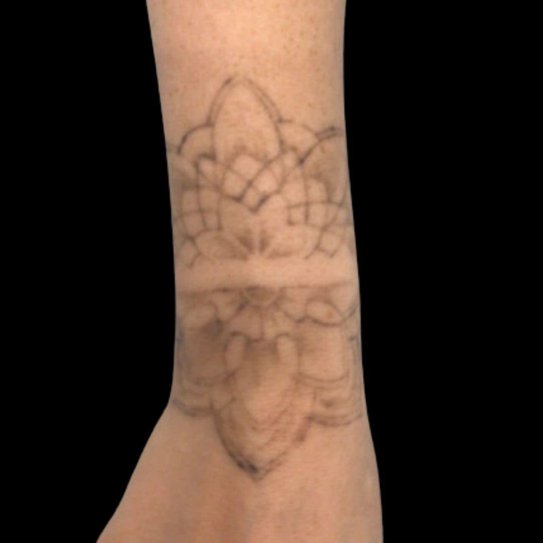 After Brooke saw amazing progress after only 3 treatments.