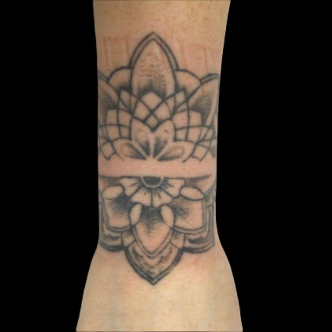 Before Brooke saw amazing progress after only 3 treatments.