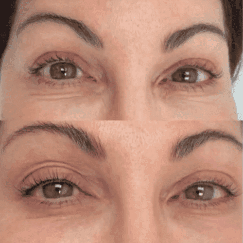 Lash Enhancement Tattoos Brisbane